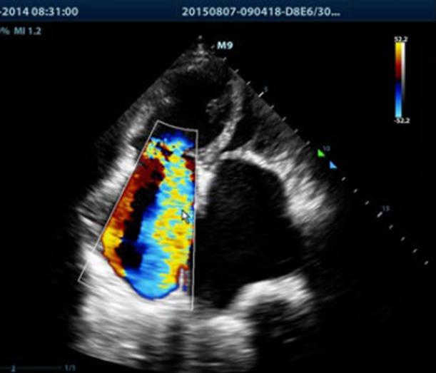 Imagen de una ecocardiografía
