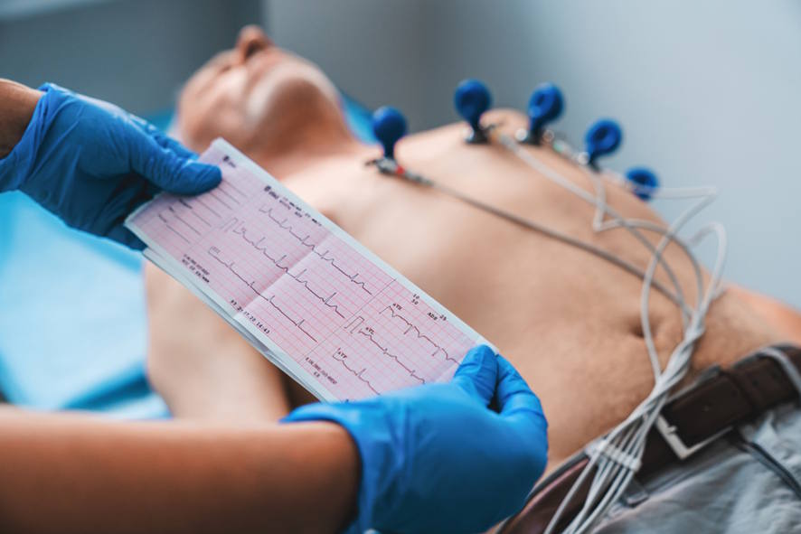 Imagen de un electrocardiograma