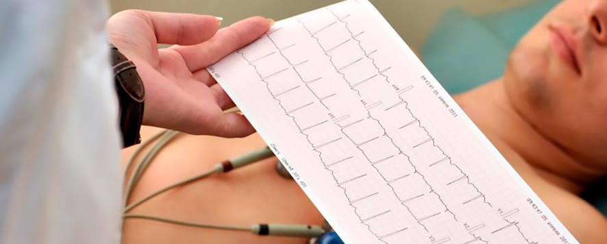 Otra imagen de un electrocardiograma
