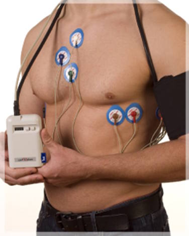 Imagen de un dispositivo holter